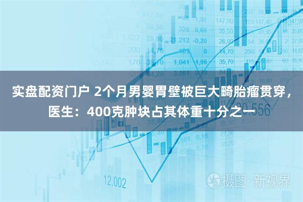 实盘配资门户 2个月男婴胃壁被巨大畸胎瘤贯穿，医生：400克肿块占其体重十分之一